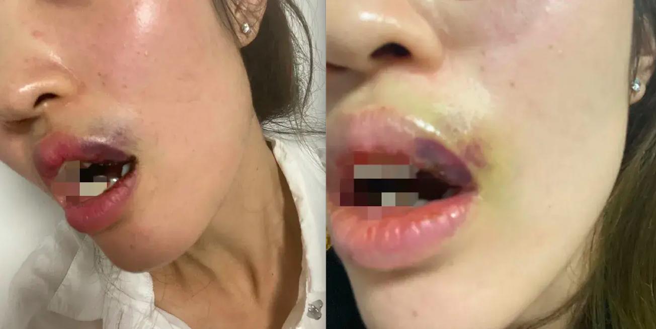 有个有本事的爹就能随便打人吗,有个有本事的爹就随便打人吗