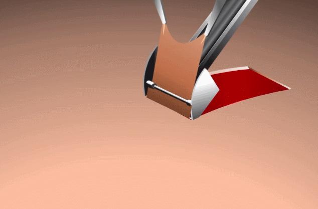 再生医学日本,日本再生医学治疗肾最新进展