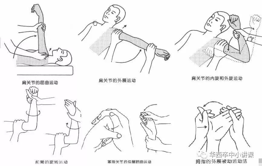 卒中病人如何自救,卒中患者需要做哪些检查