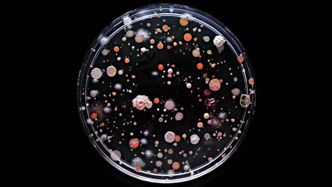 女性清洗*处私**时，要掌握这三个方法，避免感染妇科病，你学会了吗