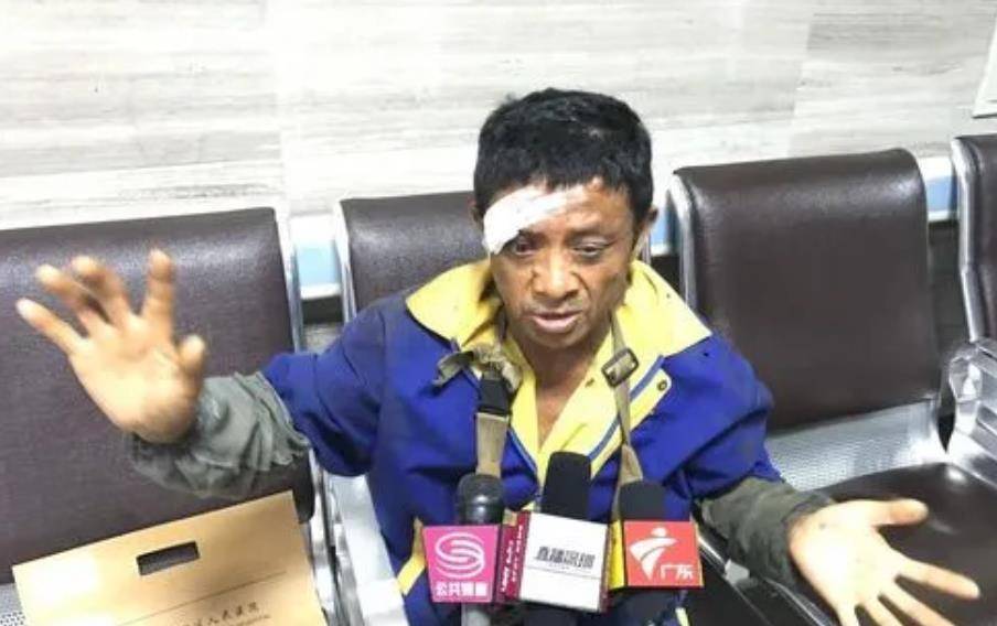 建筑工地受伤怎么处理,工地受伤鉴定不到等级怎么办