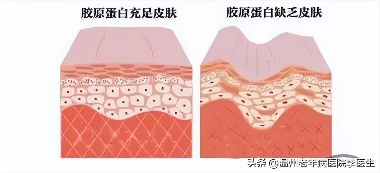 光子嫩肤真的嫩肤吗,美白嫩肤光子