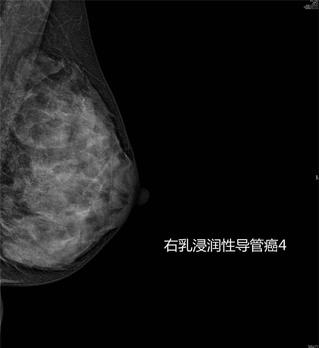 致敬公司的摄影师,美女致敬摄影师视频