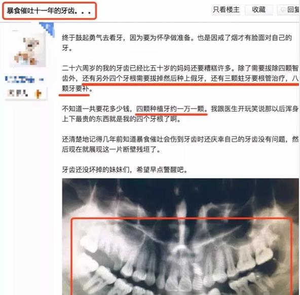 26岁女孩把50cm“仙女管”塞入体内，视频曝光：病态欲望正在蔓延