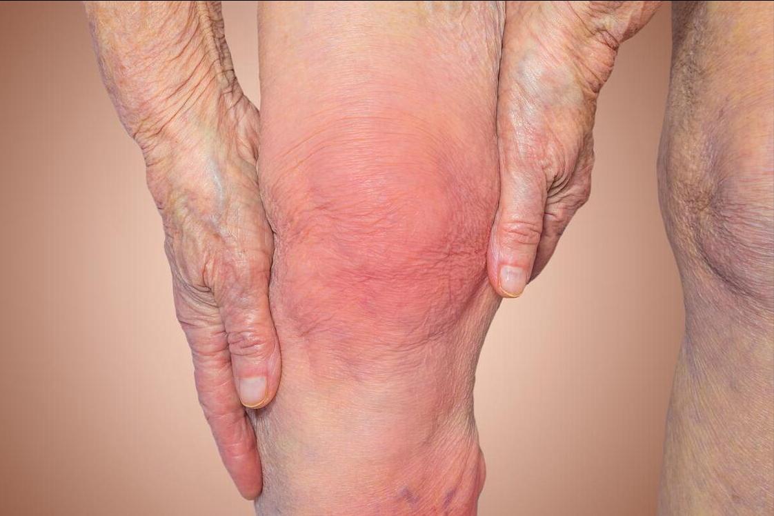 胡希恕治疗糖尿病的经方,糖尿病手脚麻木最佳疗法