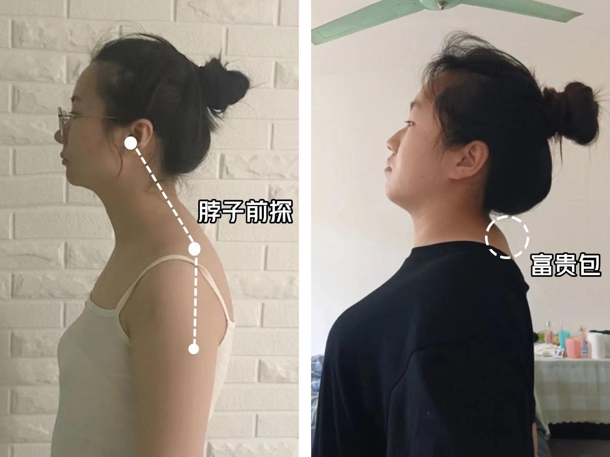 为什么体态比颜值重要,常见的9大不良体态问题