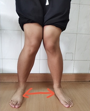 夏天来了有的人不敢穿短袖,夏天来了都不敢穿短袖呢