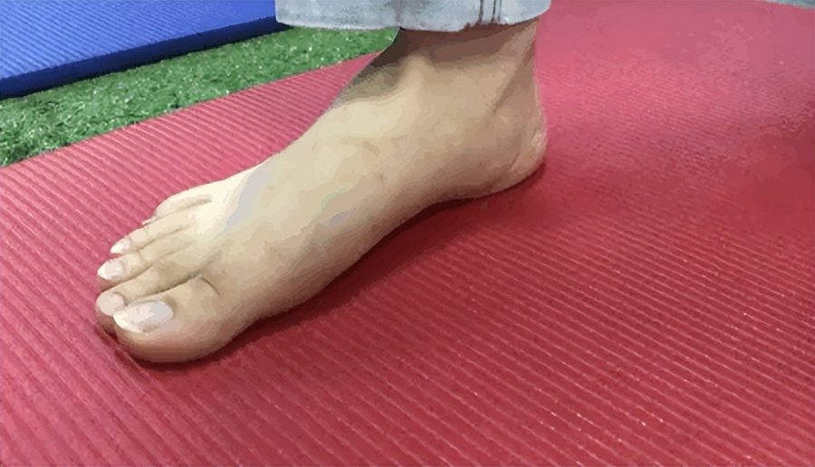 足底疼痛的自我救助