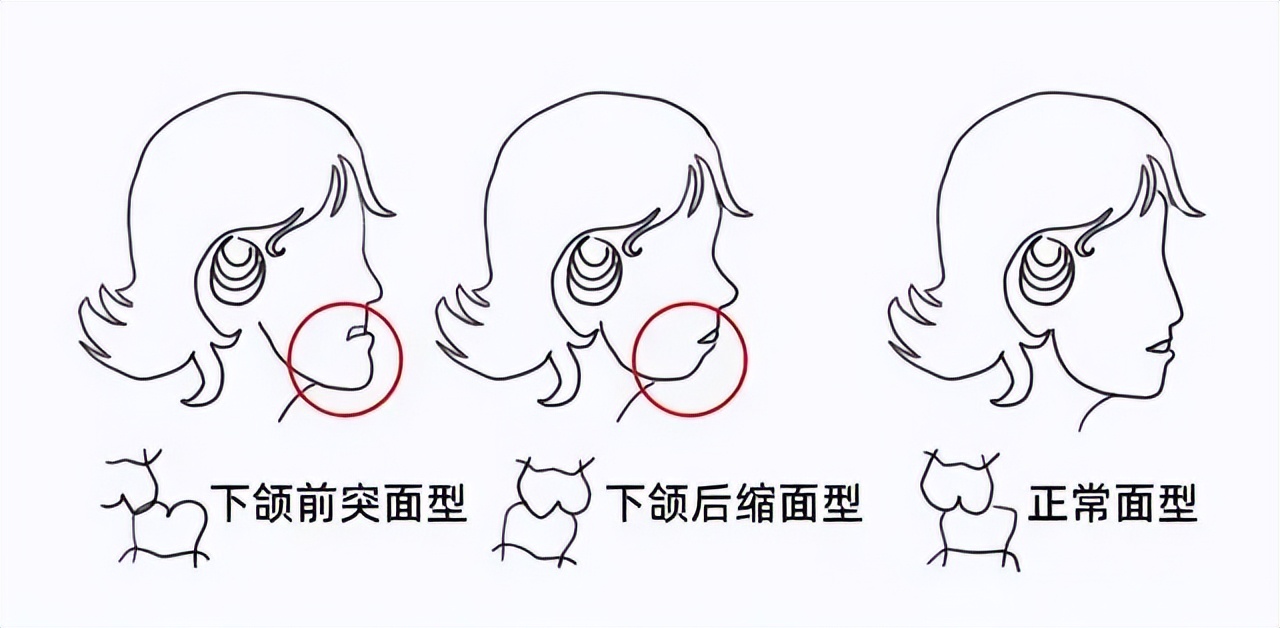 从小“咬指甲”的孩子，长大后怎么样了？一般逃不掉3种结局