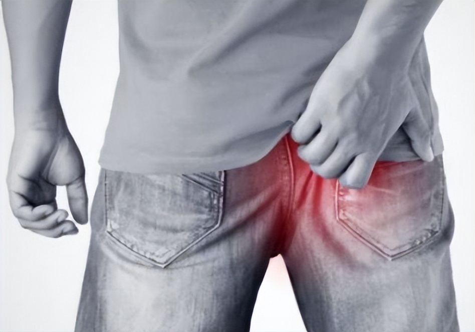 肛裂发病机理,肛裂最主要的临床表现是