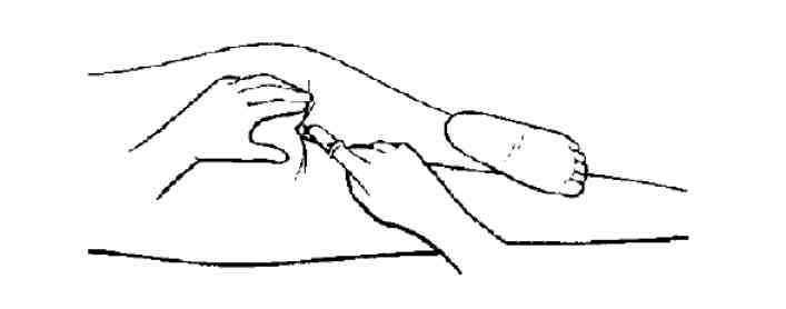 七个月宝宝退热栓的正确使用方法,婴儿退热栓为什么不建议用