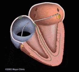 科普房颤,辨别焦虑和房颤