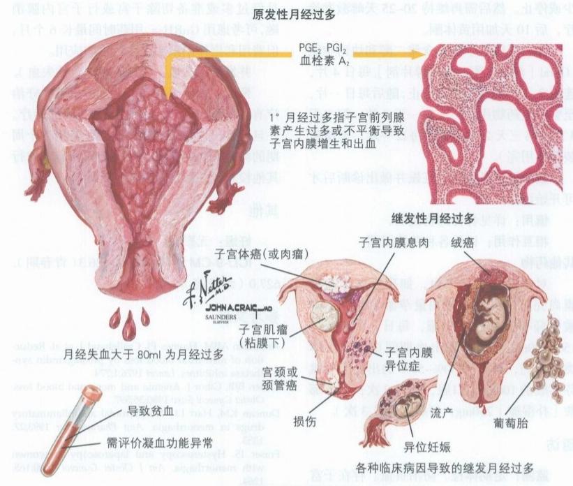 每次月经都量大如泉涌，有这样情况的女生一定要看