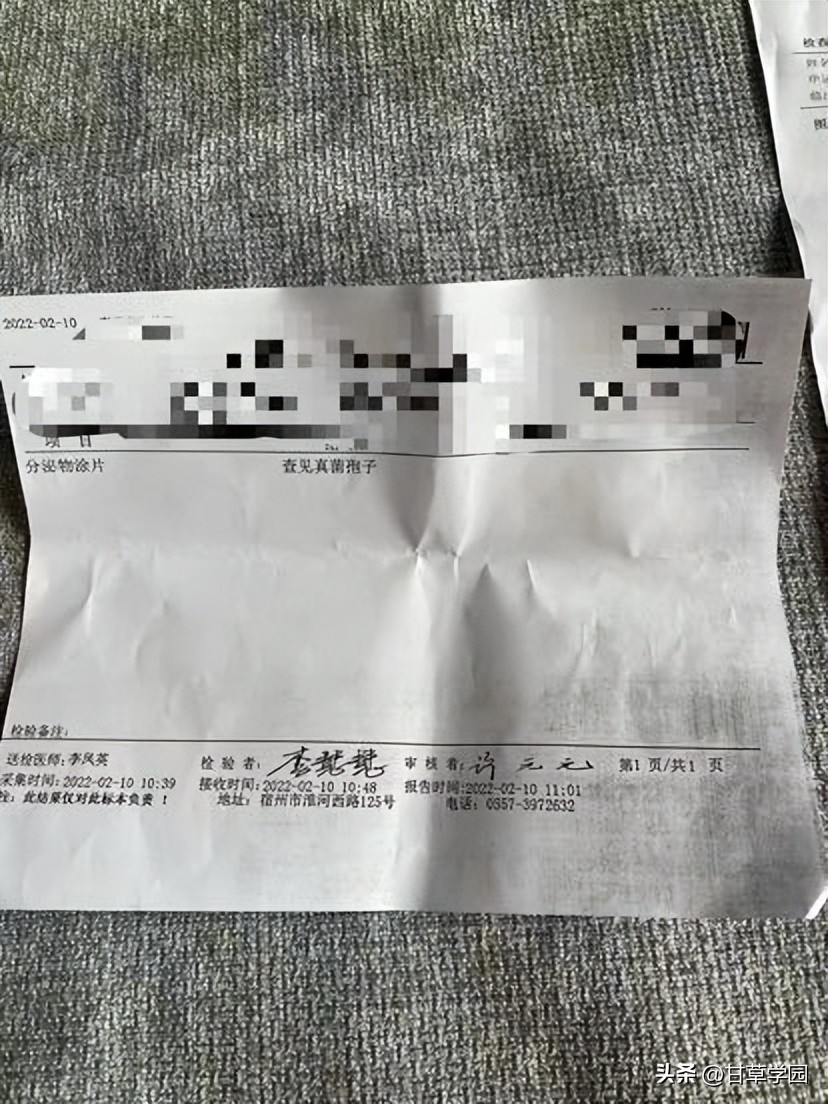 复方甘草治疗斑秃,甘草煮水治疗斑秃效果好吗