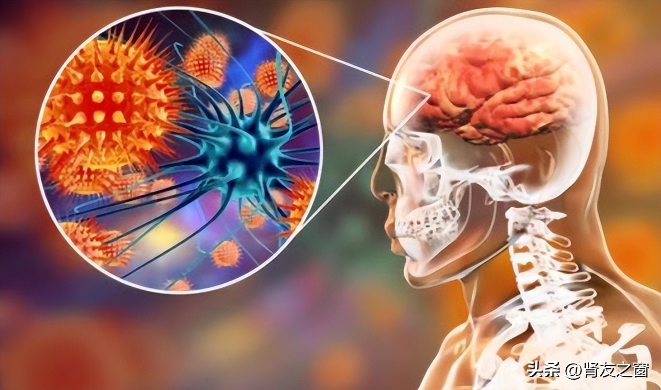 如何防治失衡综合征,失衡综合征的表现和预防