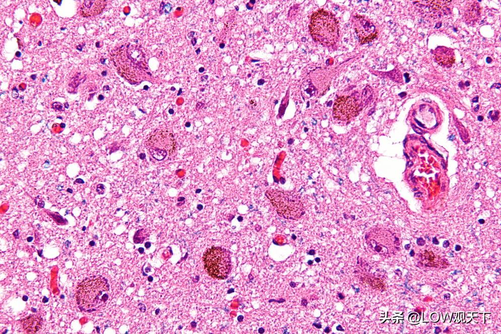 大脑中的神经元多意味着什么,大脑神经元的作用是什么