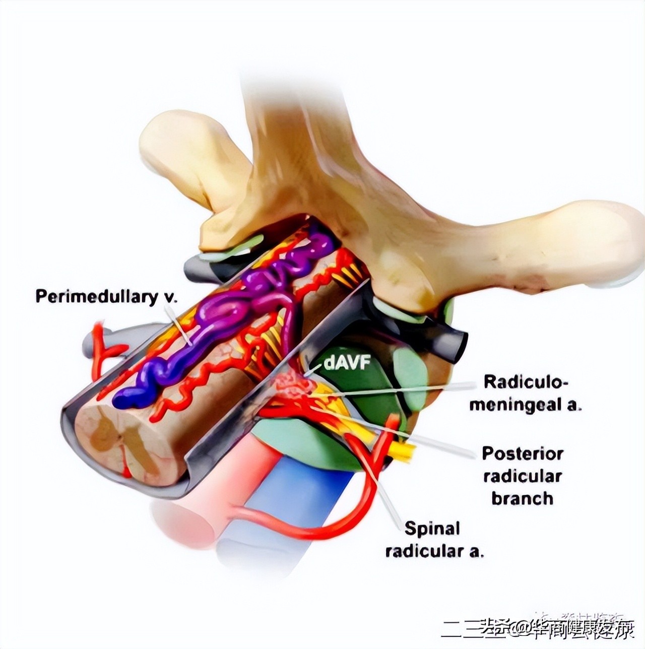 下肢无力一定是腰突引起的吗,腰椎硬脊膜瘘的症状和治疗