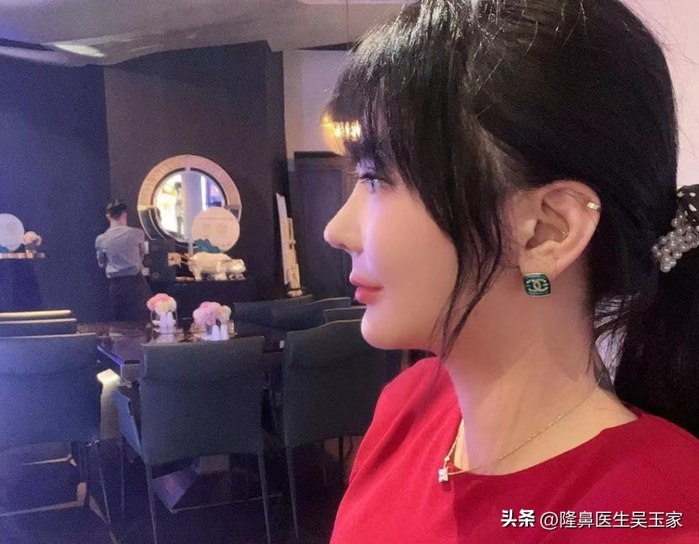 四十岁鼻基底填充玻尿酸,什么人适合做鼻基底填充