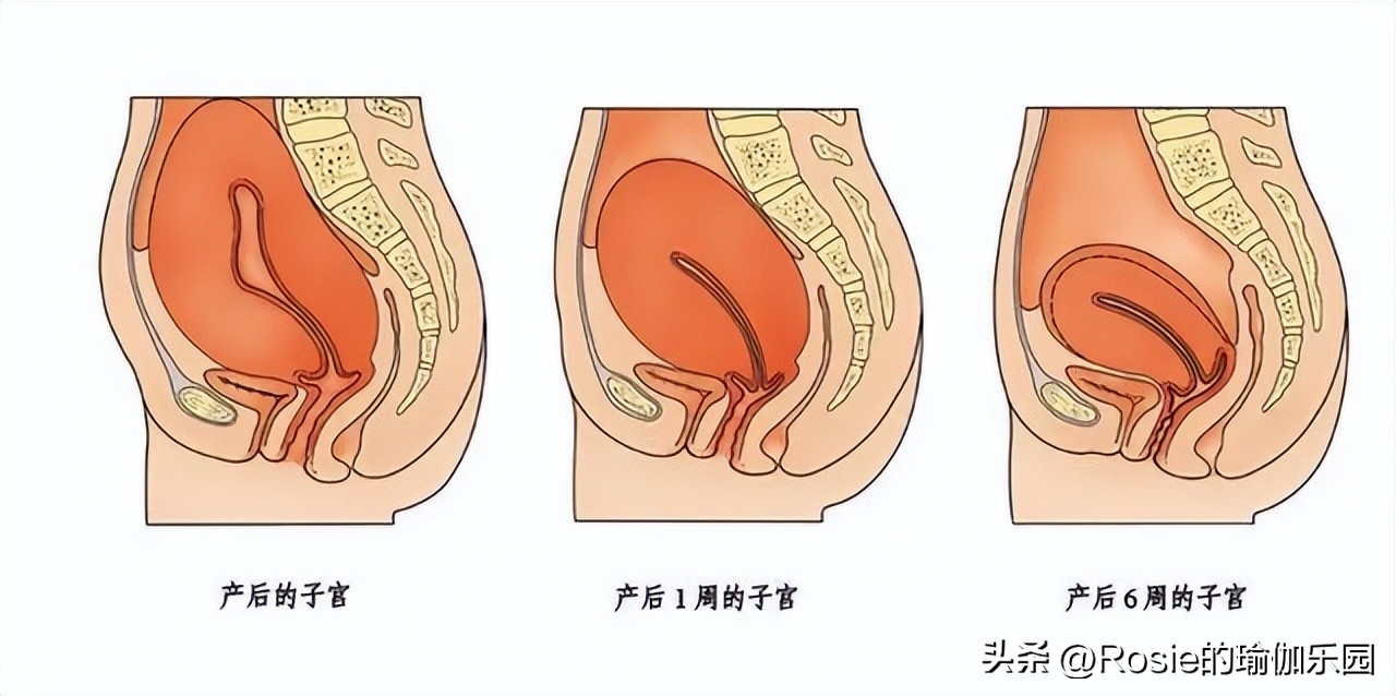 李念生三胎状态超好，产后妈咪肚漏尿怎么办？产后修复这样做