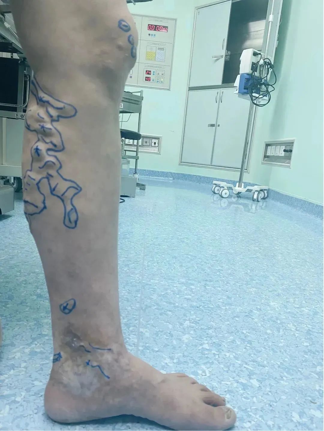 花都中医院病例,花都有多少病例