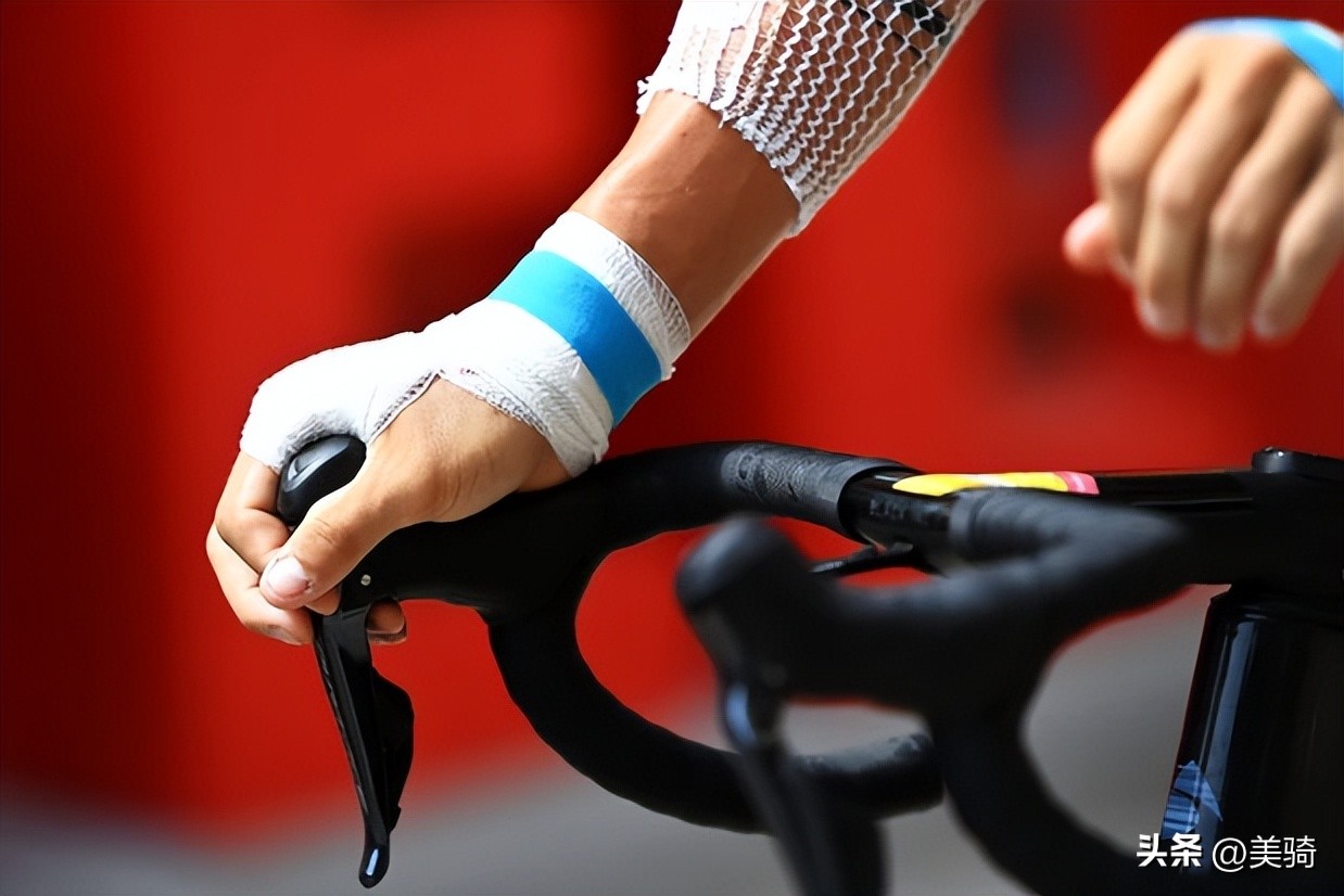 轻微交通事故皮外伤怎么处理,骑车擦伤的正确处理方法