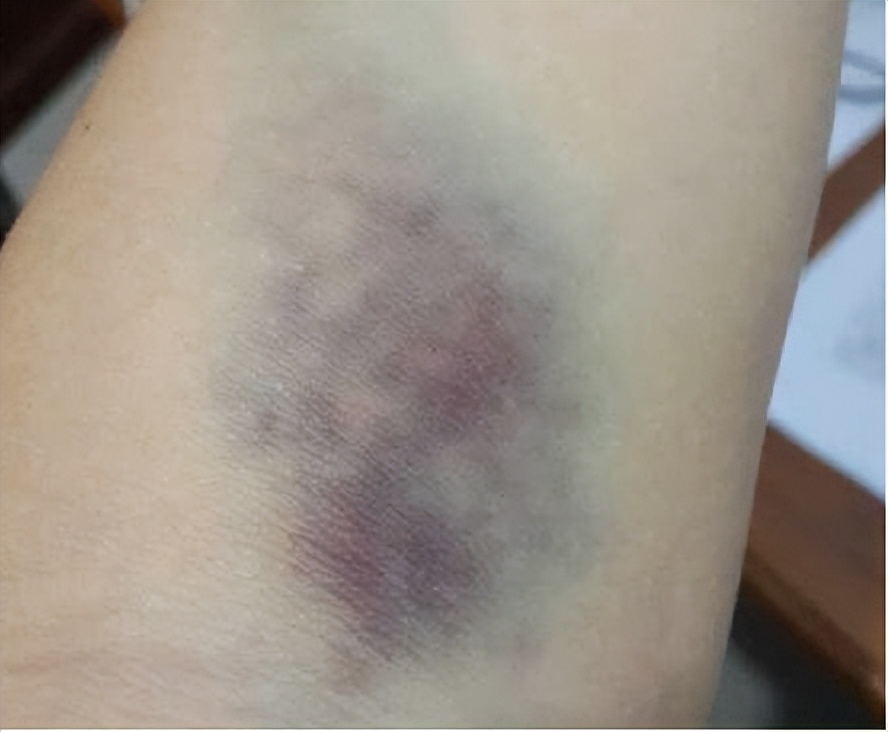 筋膜枪到底有多聪明,筋膜枪的弊端