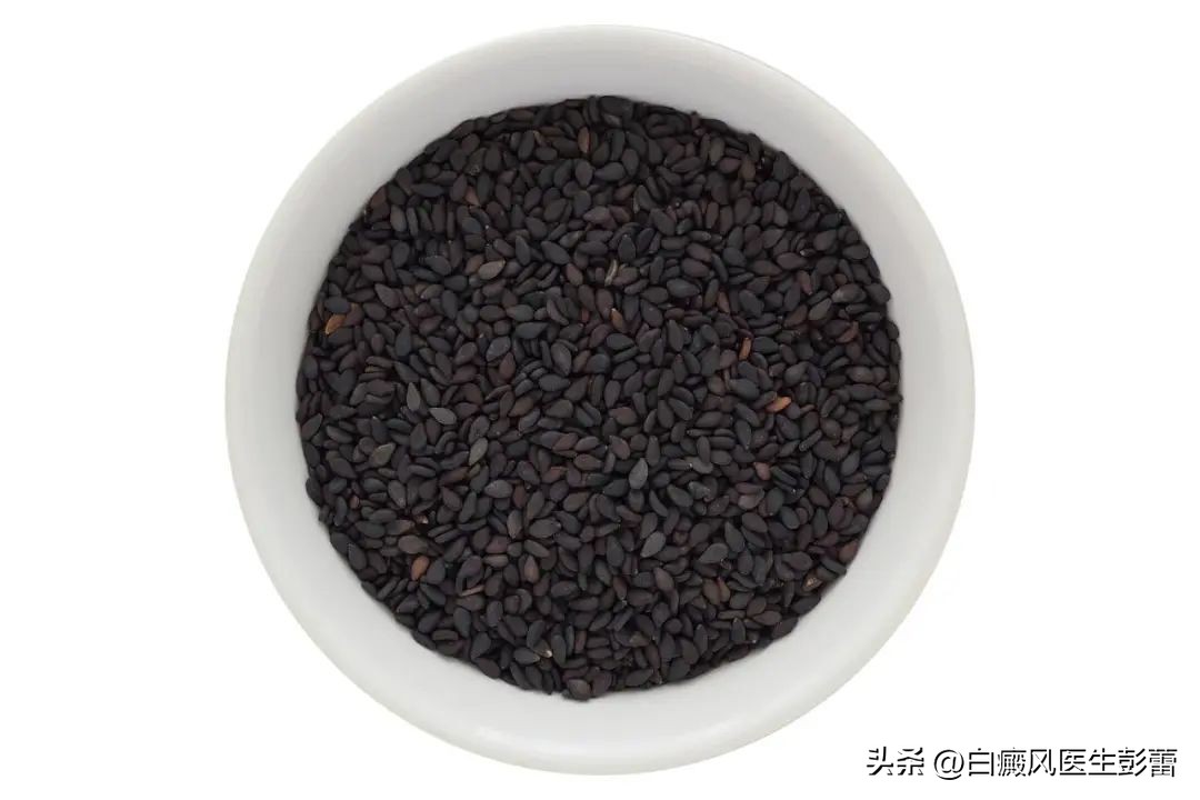 吃黑豆黑米黑芝麻能改善白癜风吗,吃了三个月的黑芝麻白癜风就消了