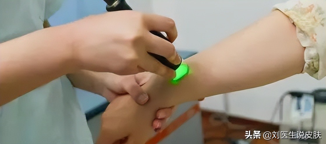 手部的白癜风怎样能治好,手部白癜风怎么治疗最好