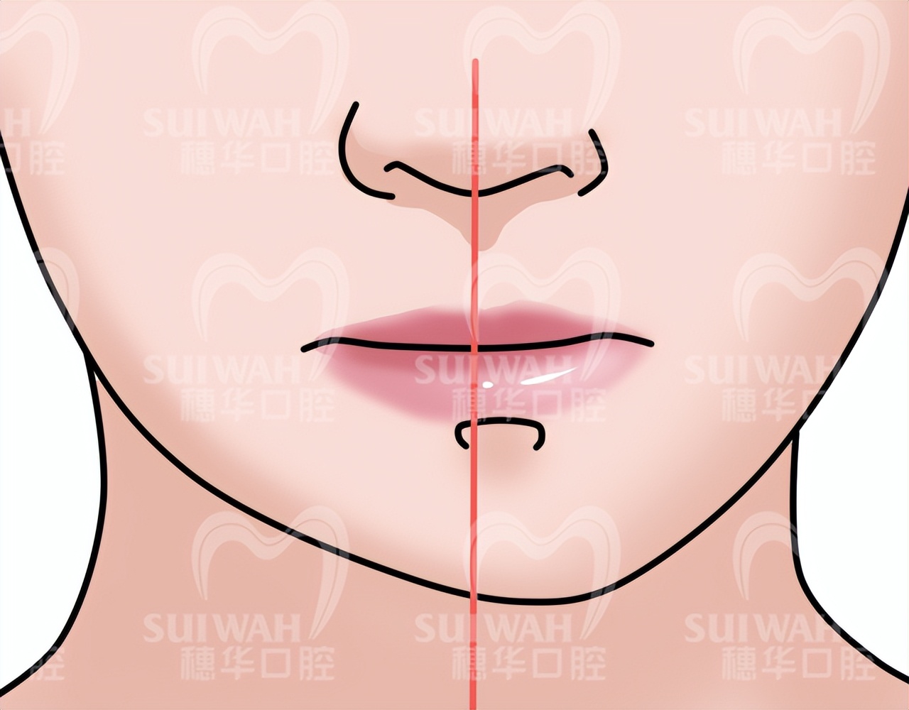 北大口腔医院儿童牙齿不齐矫正,儿童牙齿矫正北京大学口腔医院