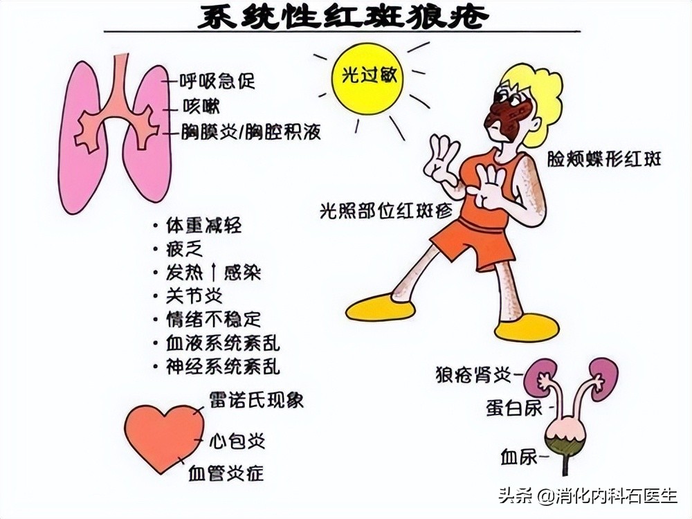 22岁女子眼痛、干涩反复发作，内科主任：再晚点，肾就没了