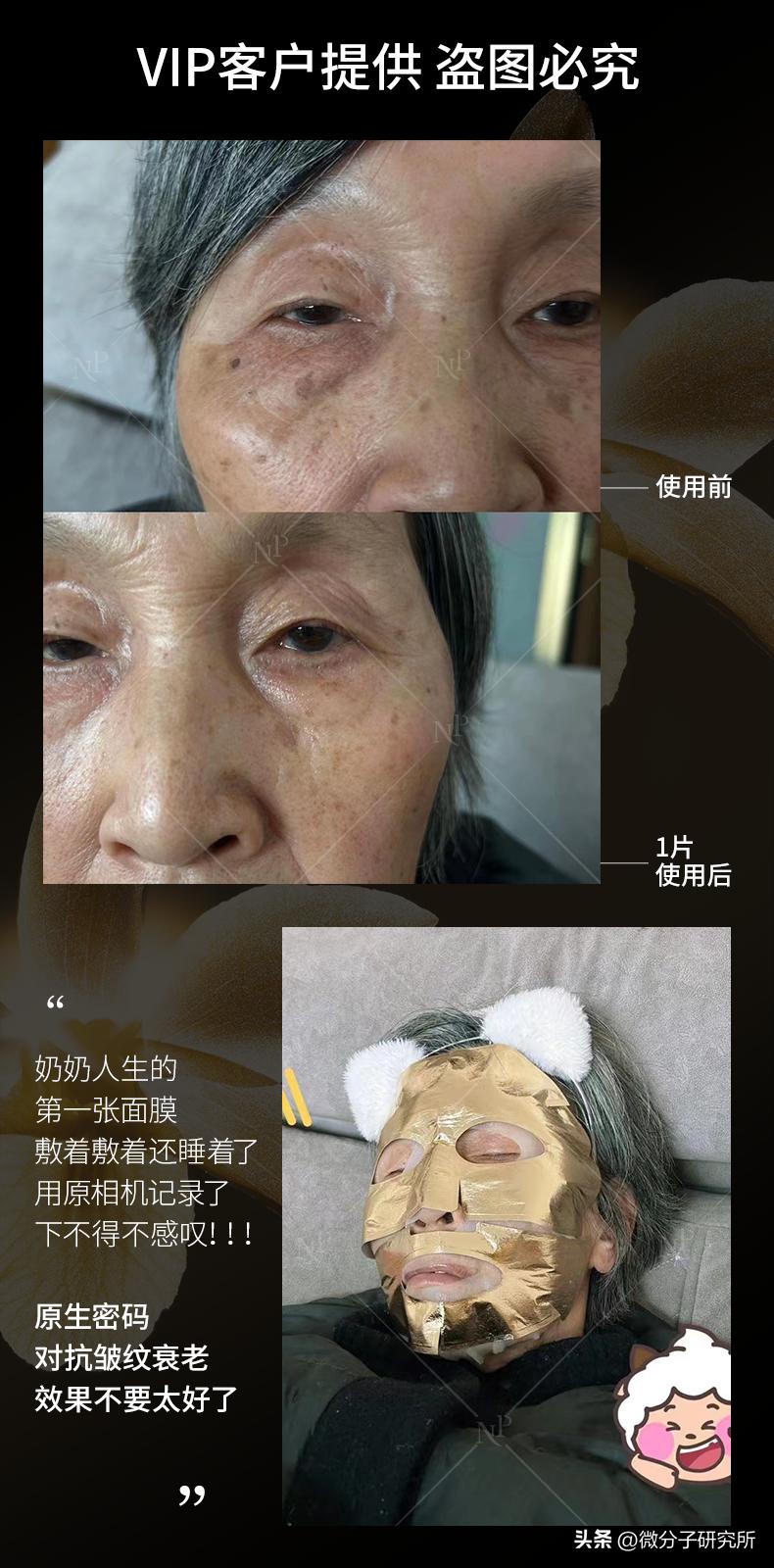 热玛吉后用的提拉面膜,热玛吉以后要医美面膜么
