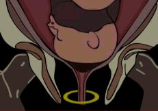 宫颈口松弛导致宫颈妊娠的几率,宫颈松弛有可能恢复吗