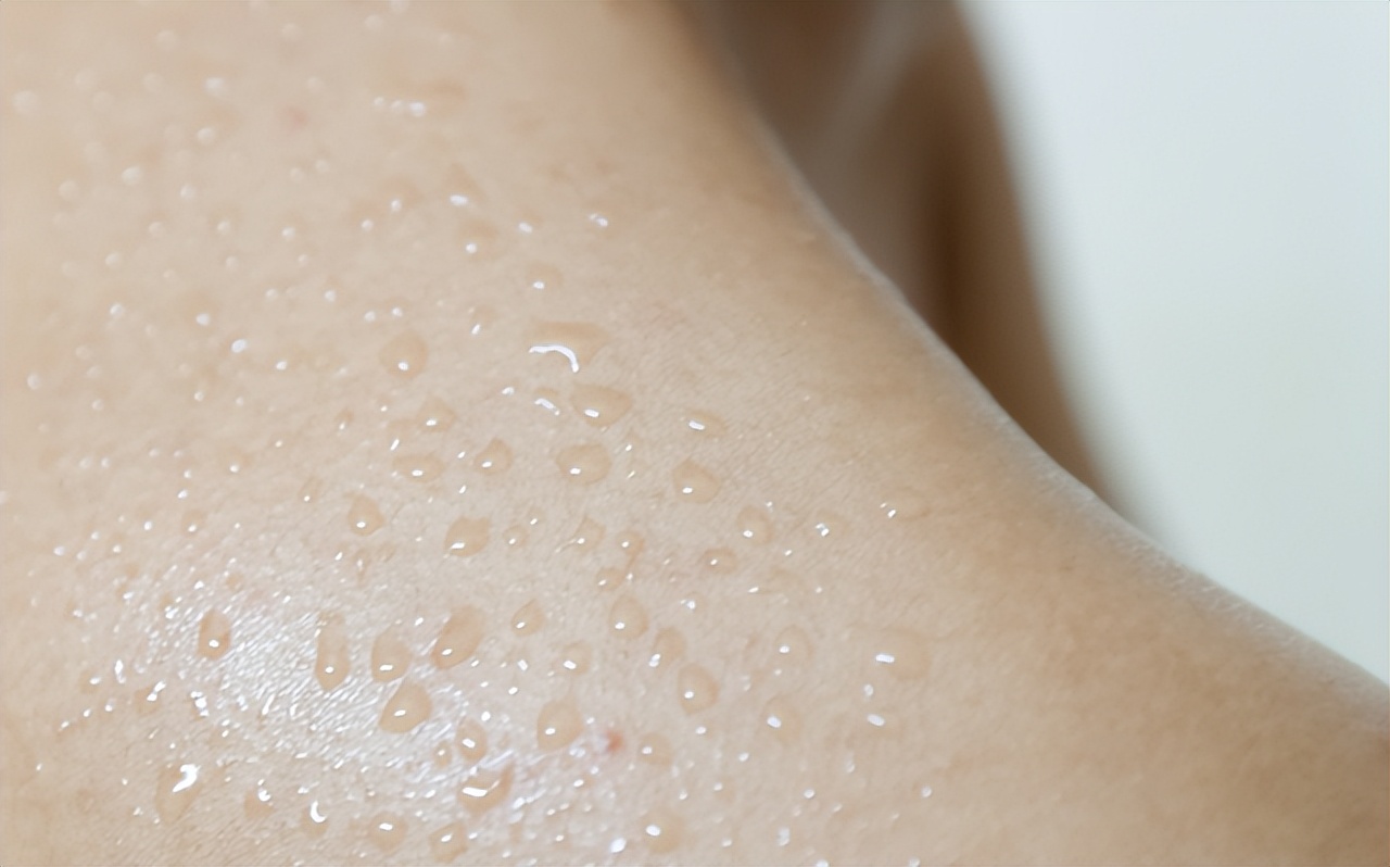 动不动就出汗晚上也出汗怎么治,易出汗出汗多是易瘦体质吗