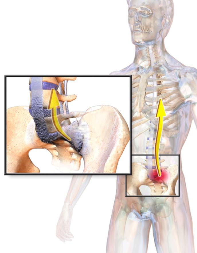 治疗强直性脊柱炎必须按体质治吗,针对强直性脊柱炎最好的锻炼方法