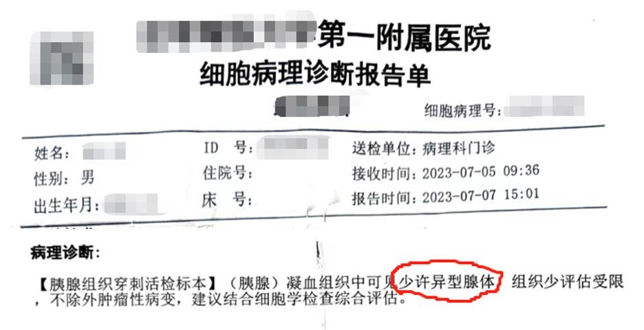 如何最终确诊?发现胰腺占位:穿刺病理的重要性