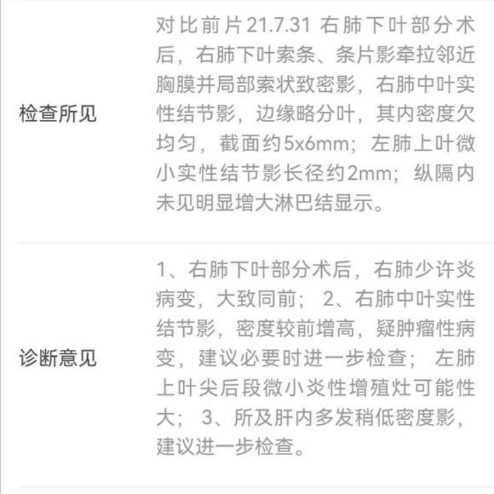 11mm混合磨玻璃结节是浸润癌概率,7mm的混合磨玻璃结节容易转癌吗