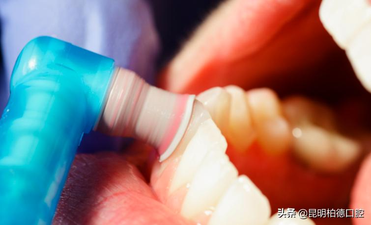 洗牙喷砂和龈下刮治的区别,洗牙套餐里喷砂是什么意思