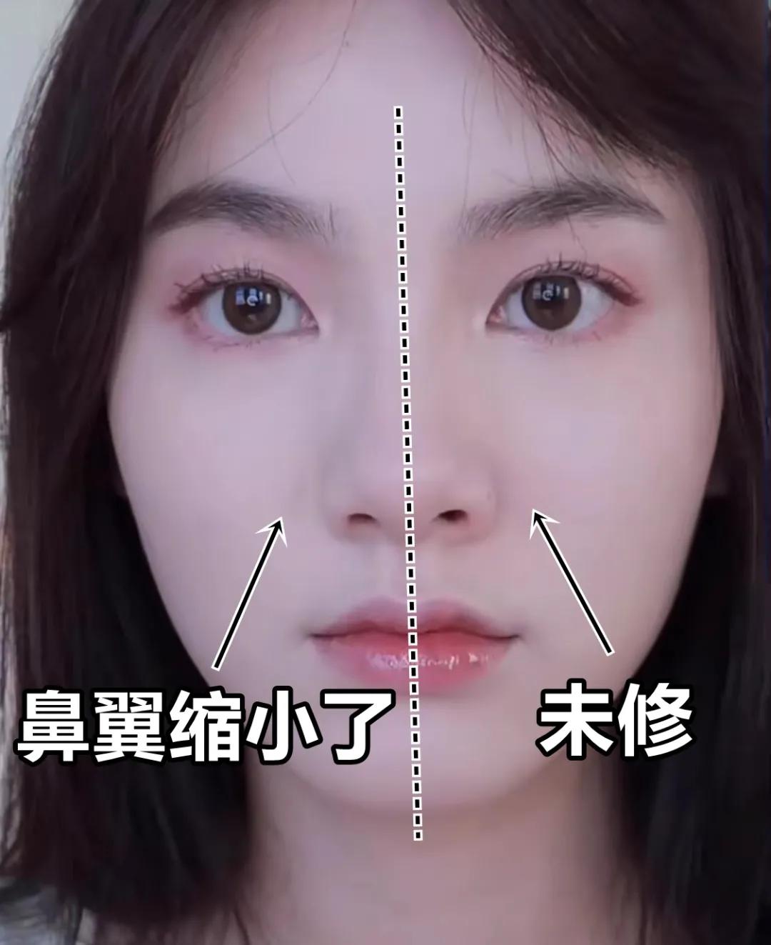 塌鼻梁的变美思路,塌鼻子变美小技巧视频教程