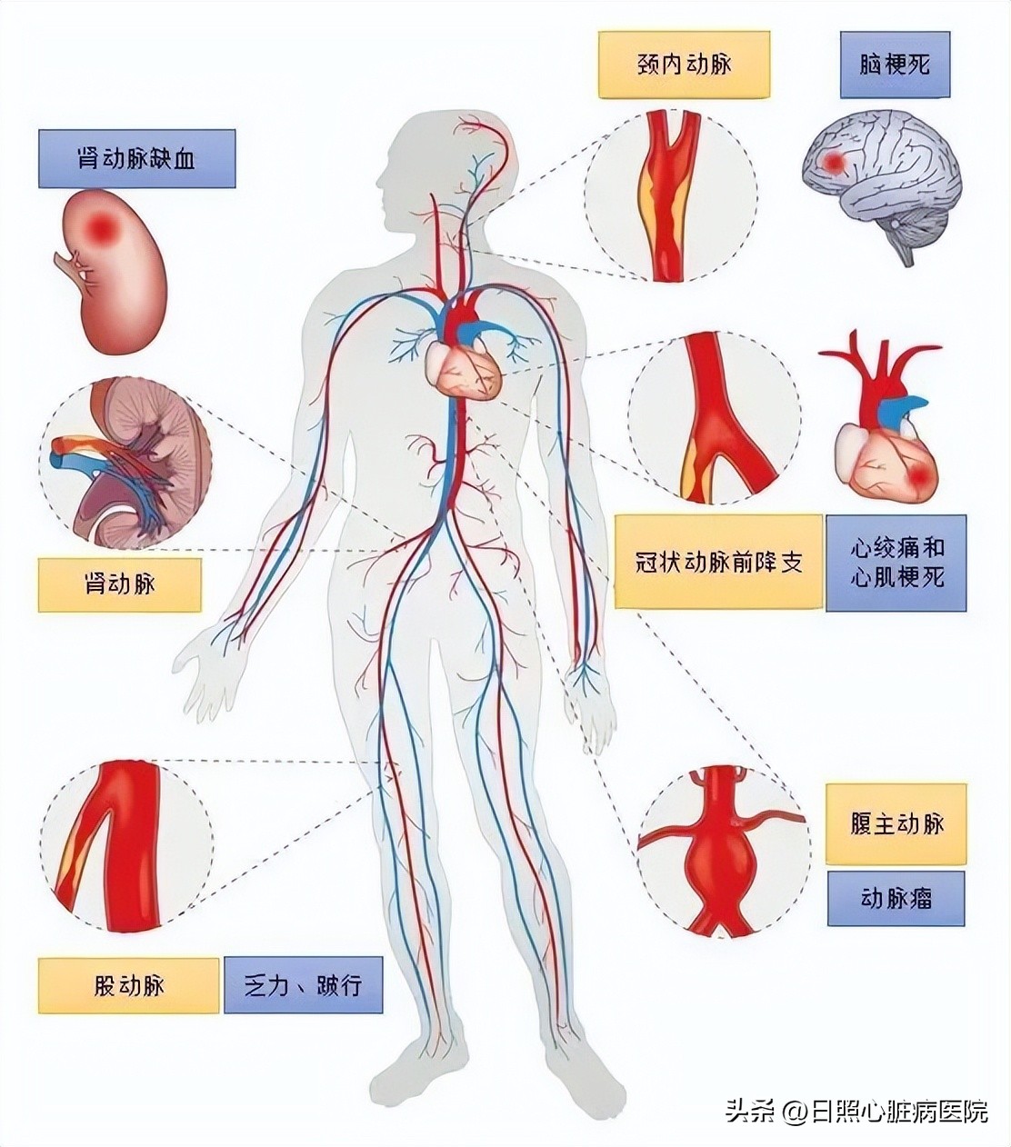 腿脚发凉别大意可能是大病,腿脚冰凉是不好的征兆吗