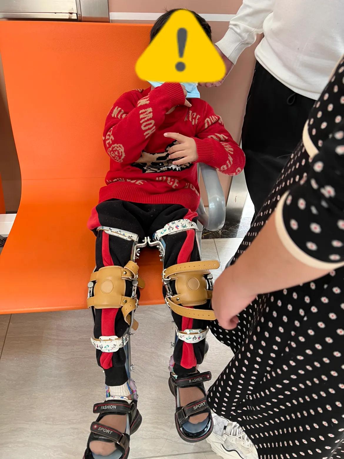 痉挛肌脑瘫家庭干预可以吗,痉挛性脑瘫患儿康复训练家长必看