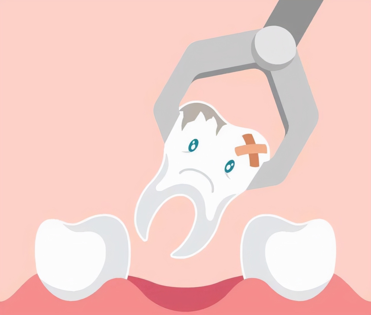鎷旂墮鍚庢敞鎰忎簨椤瑰彲浠ユ娊鐑熷悧,鎷旂墮鍚庢敞鎰忎簨椤逛笌绂佸繉椋熺墿