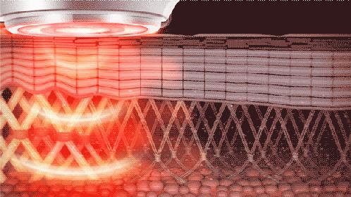 黑科技美容仪可紧致肌肤有弹性,黑科技美容仪