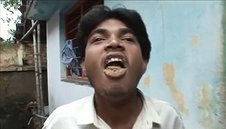 故事:非洲22岁小伙吃沙子上瘾,一天要吃五斤,身体发生怎样改变