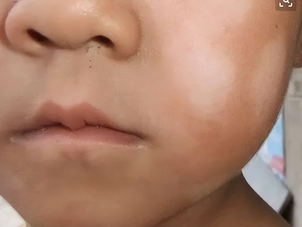 医疗美容和皮肤病有什么区别,医疗美容与皮肤科