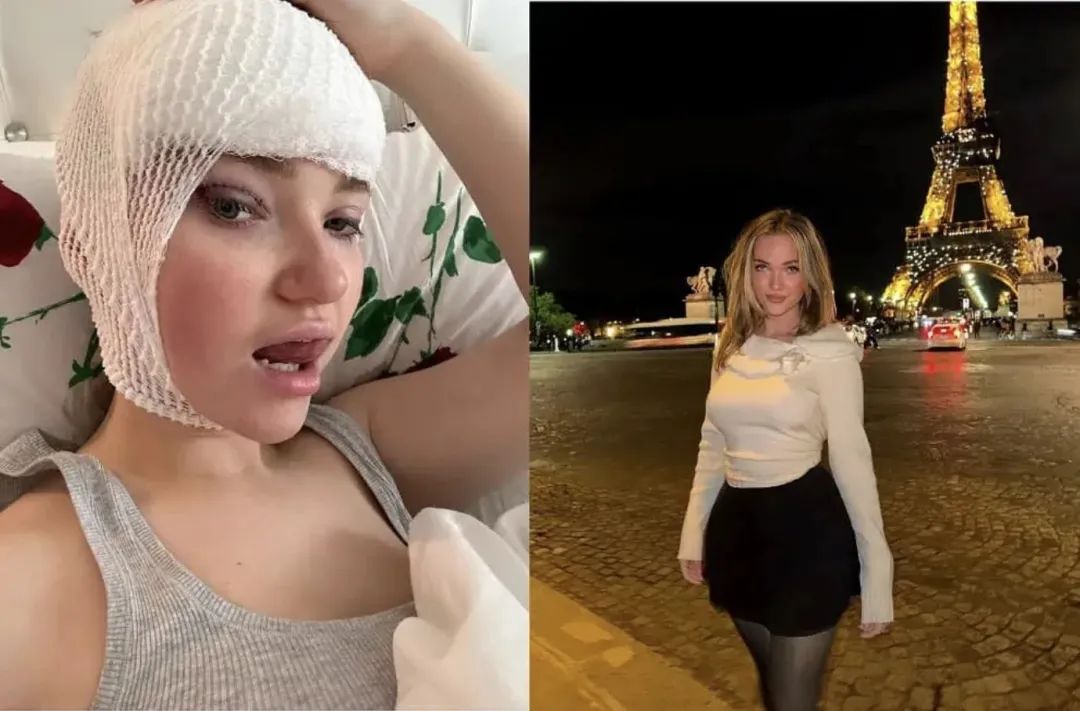 卡戴珊身体整形,卡戴珊做了哪些整容手术