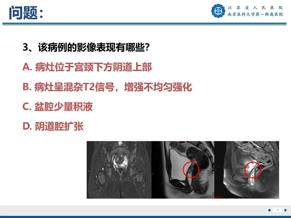 好文分享——《胚胎型横纹肌肉瘤》