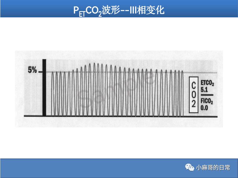 呼气末二氧化碳检测图的解读,呼气末二氧化碳检测操作视频