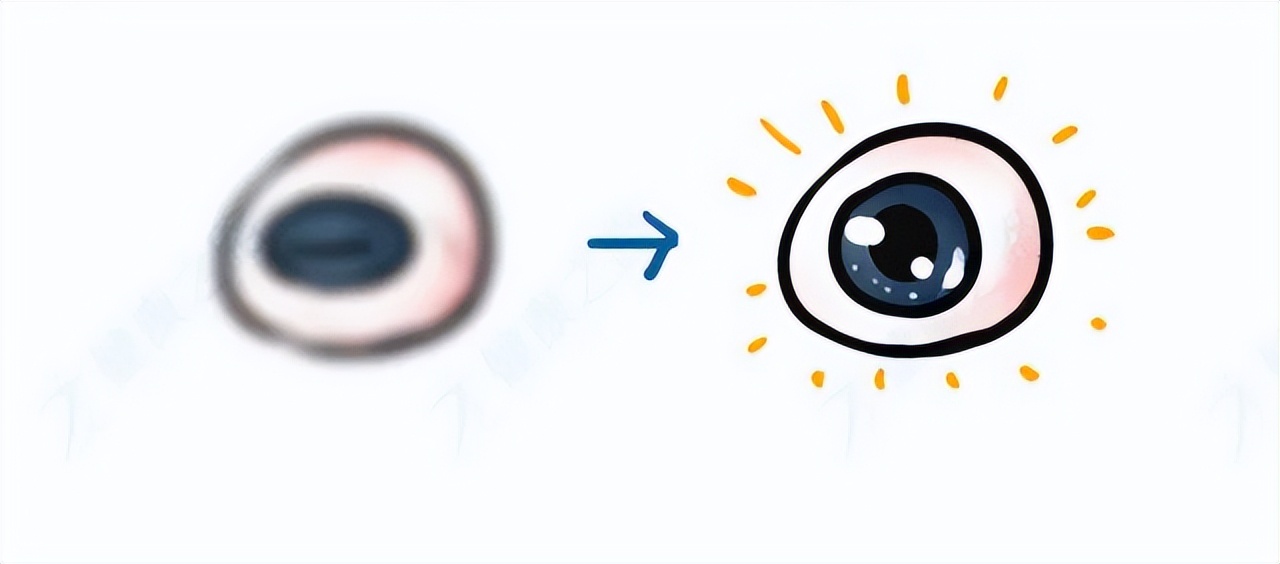 眼药水不能乱用小心伤眼睛,眼药水禁用品牌