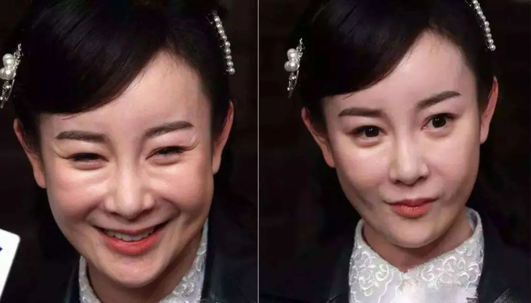 一笑就出法令纹和眼角纹？这两大成分专攻“表情纹”，就是太费钱