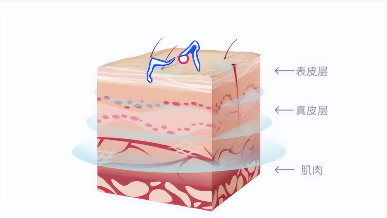 家用美容仪哪个效果最好,家用美容仪视频教程